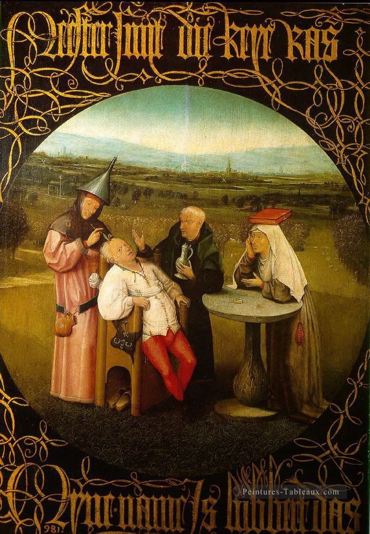 la guérison de la folie Hieronymus Bosch Peintures à l'huile